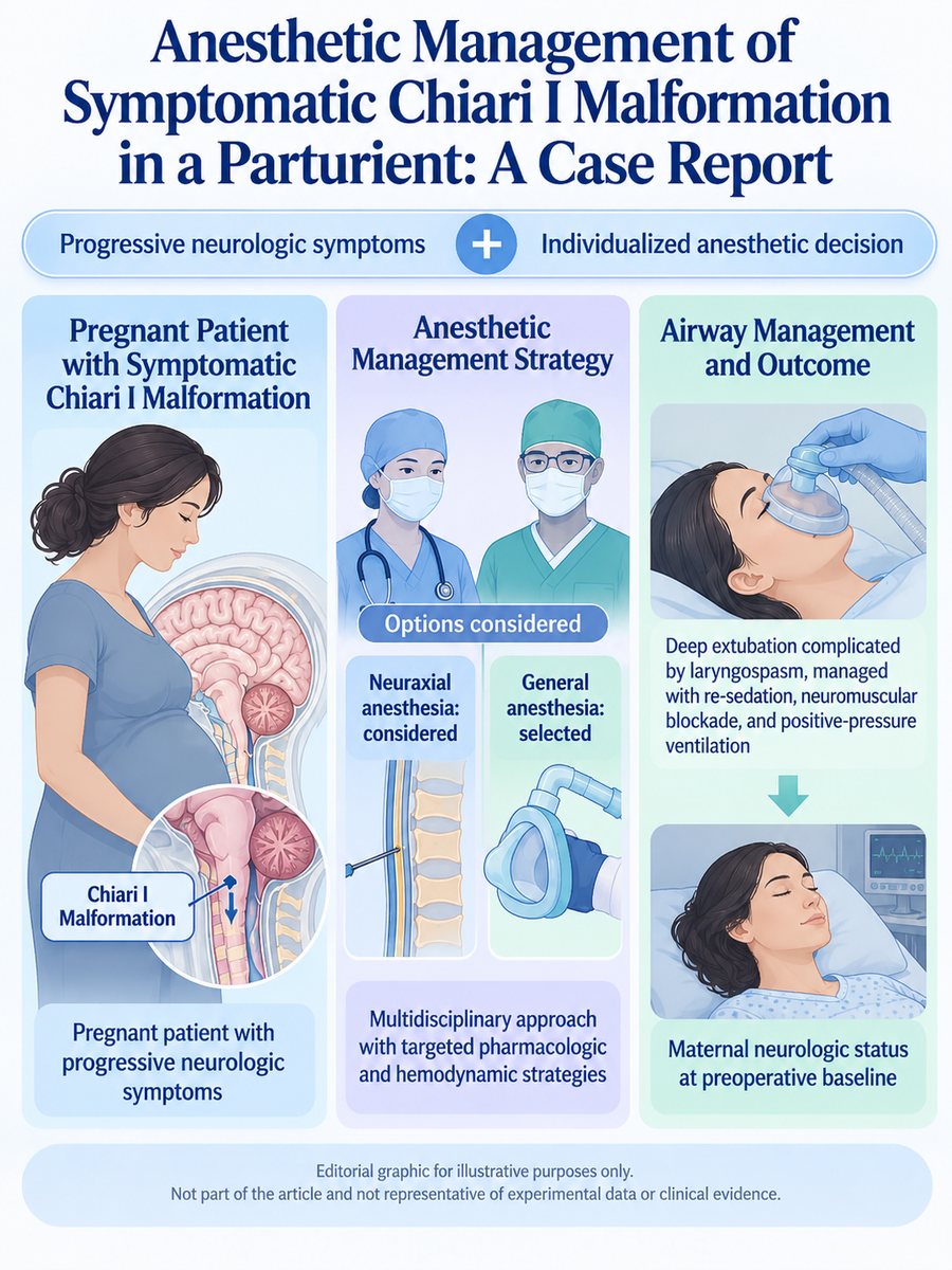 Medical infographic illustrating anesthetic management of a pregnant patient with symptomatic Chiari I malformation, including progressive neurologic symptoms, consideration of neuraxial and general anesthesia, multidisciplinary management, laryngospasm during deep extubation, positive-pressure ventilation, and return to preoperative neurologic baseline.
